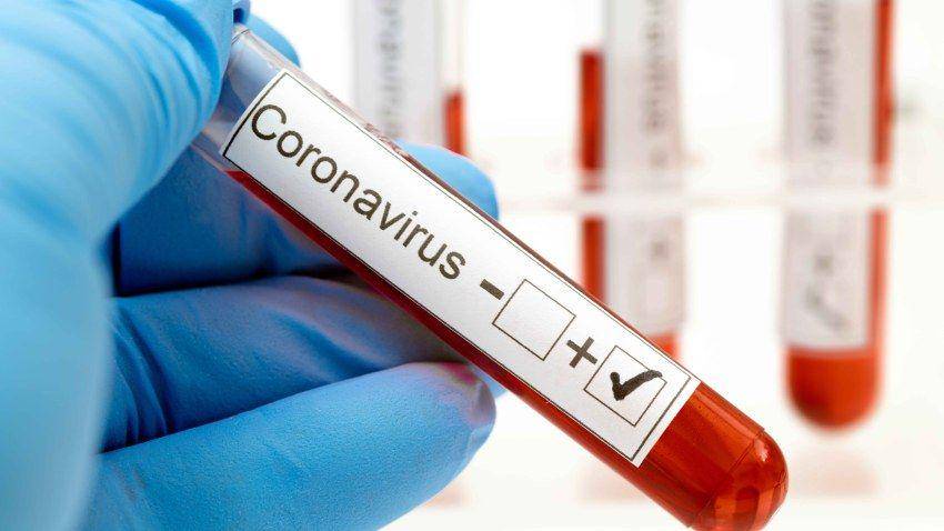 ilustrasi Corona Virus nbclosangeles.com