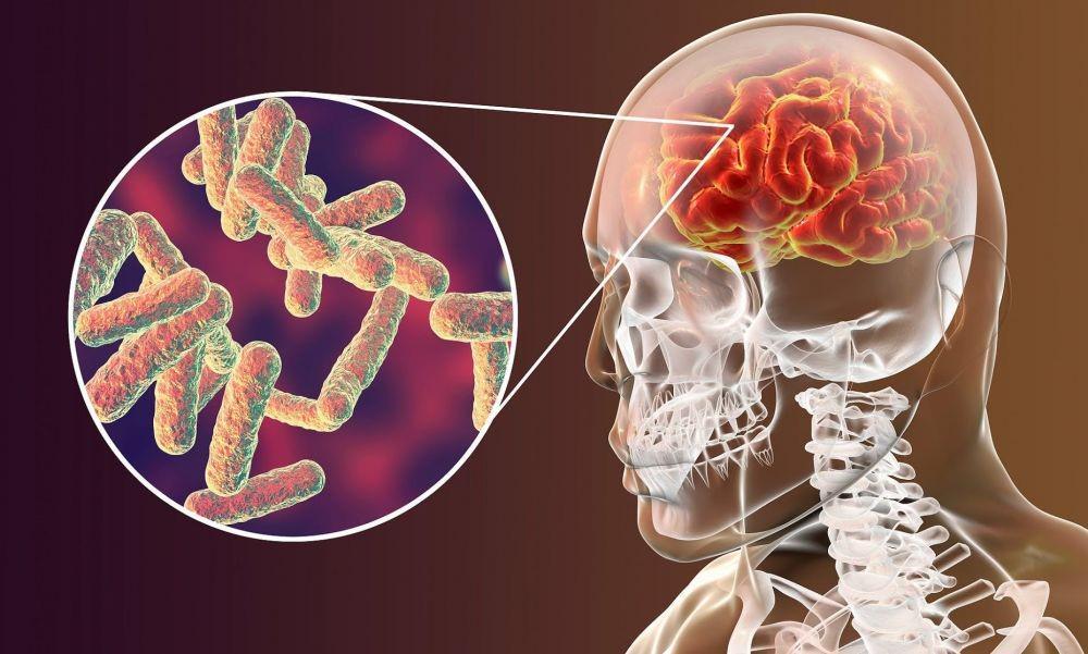 Penyebab Meninggalnya Glenn Fredly, Ini 8 Cara Mencegah Meningitis