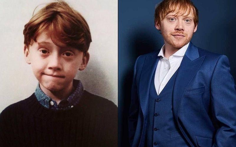 Bakal Jadi Ayah, 10 Transformasi Rupert Grint 'Ron Weasley' dari Kecil