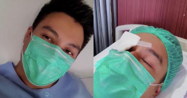 Derita Katarak, 10 Momen Perjuangan Operasi Mata Baim Wong