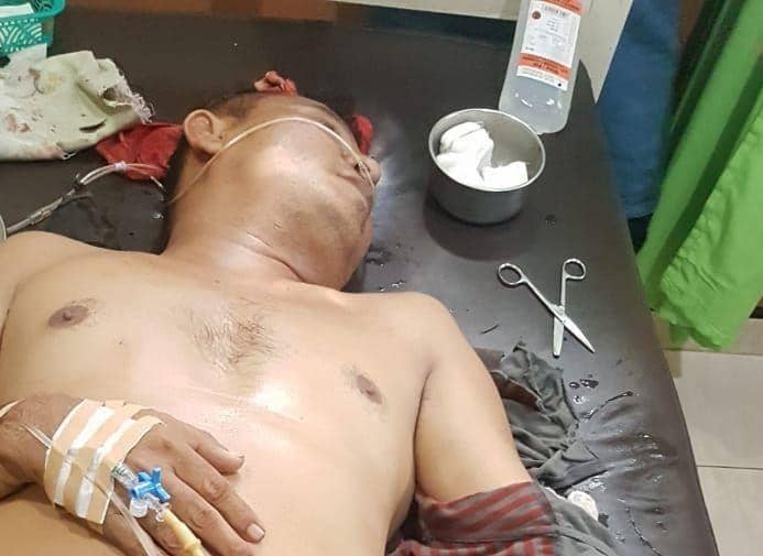Kepala desa yang diserang dengan kapak (Dok.IDN Times/istimewa)