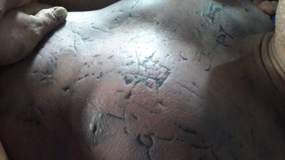 Ilustrasi luka luka yang diderita korban (IDN Times/ istimewa)