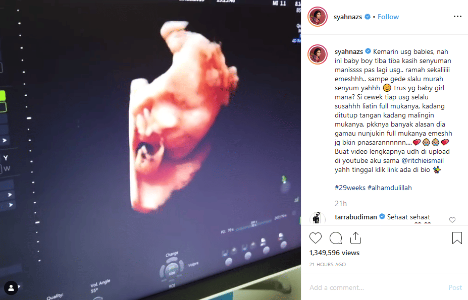 instagram.com/syahnazs/