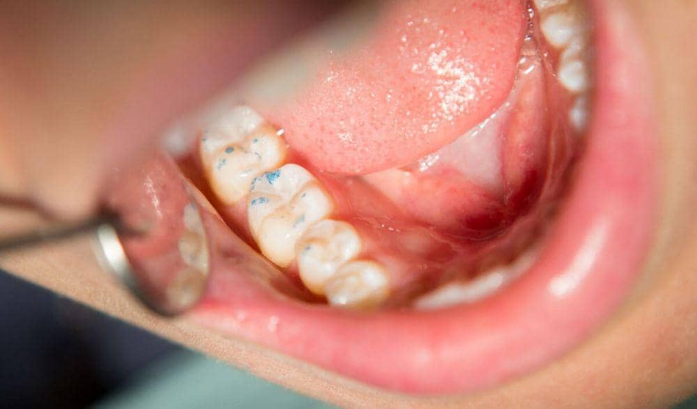 keelandental.com