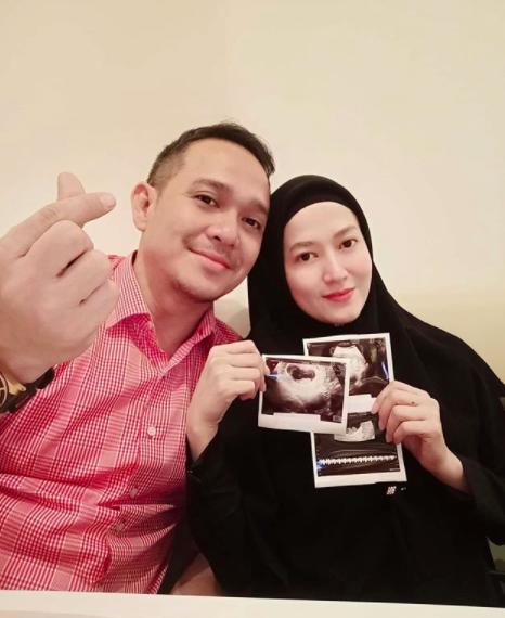 Hamil Setelah 7 Tahun Menikah, 10 Kebahagiaan Lyra Virna & Suami