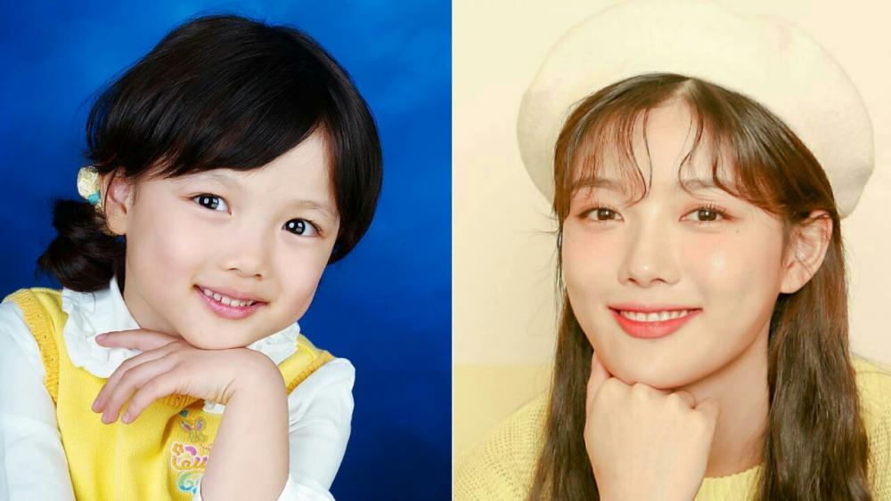 10 Potret Masa Kecil Kim Yoo Jung, Bukti Sudah Manis dari Dulu!
