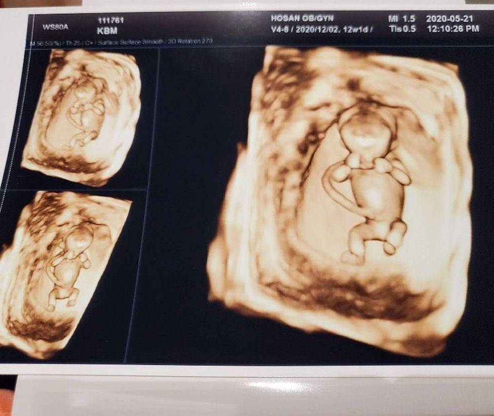 Instagram.com/bbomi0515/