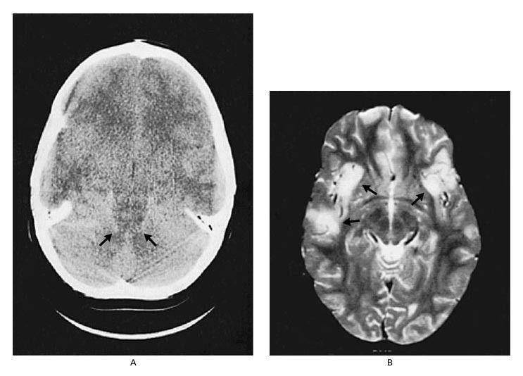 nejm.org