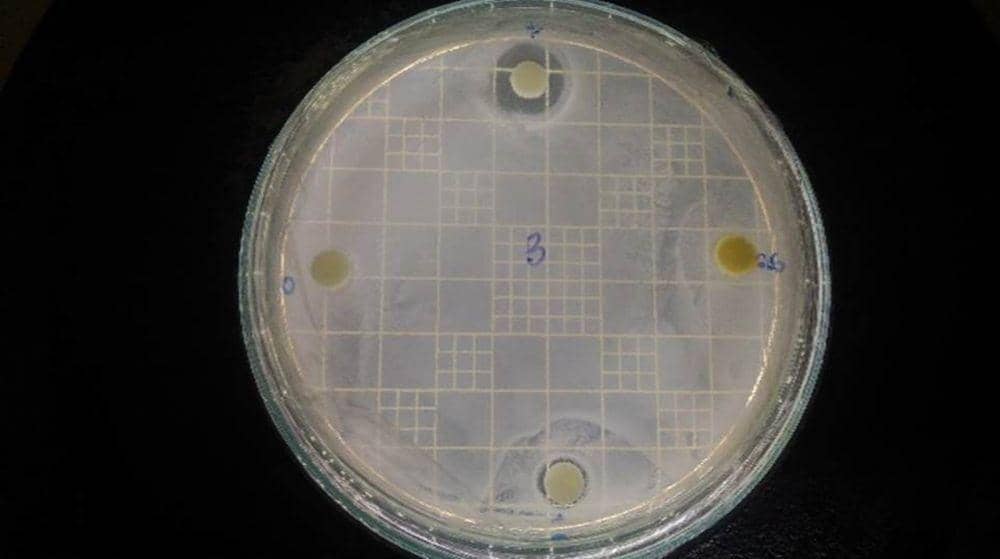Mahasiswa UNY Teliti Salep Berbahan Daun Waru untuk Infeksi Kulit