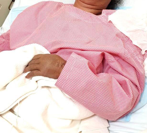 Derita TKW Sulasih Disiksa dan Disiram Klorin oleh Majikan di Saudi