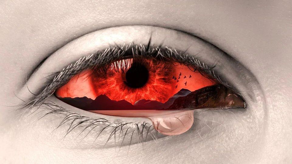 6 Fakta Medis Konjungtivitis, Gak Kalah Ngeselin dari Bintitan
