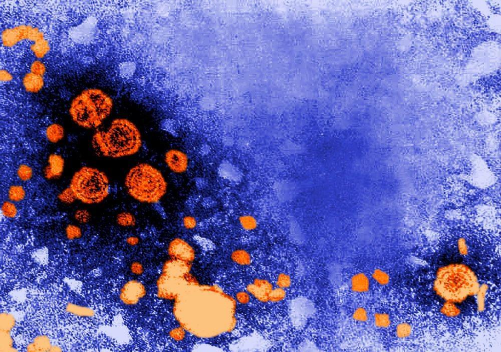5 Jenis Hepatitis dan Perbedaannya, Tak Hanya A dan B!