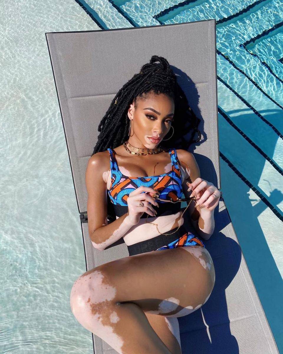 instagram.com/winnieharlow