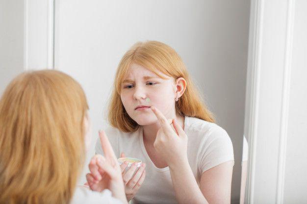 Cara atasi peradangan kulit akibat salah skincare, bisa pakai es