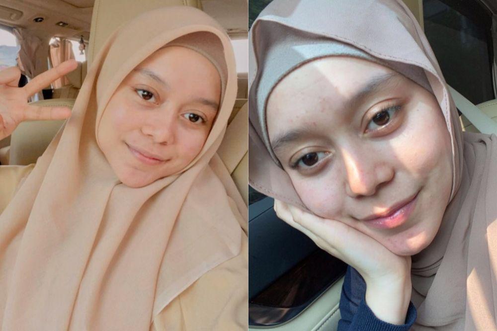 10 Potret Sederhana Lesti Kejora Tanpa Makeup, Manisnya Gak Luntur!