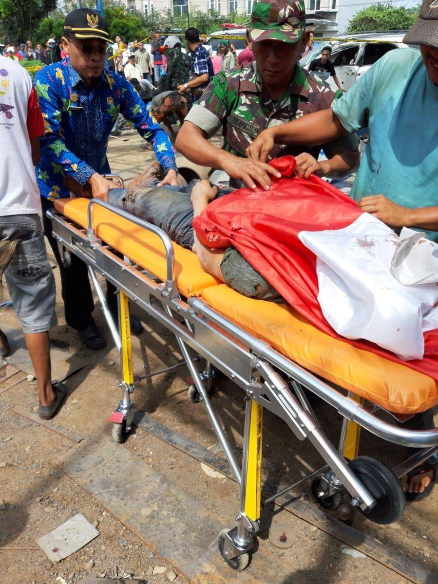 Salah satu korban yang mengalami luka akibat meledaknya bengkel las (IDN Times/ istimewa)