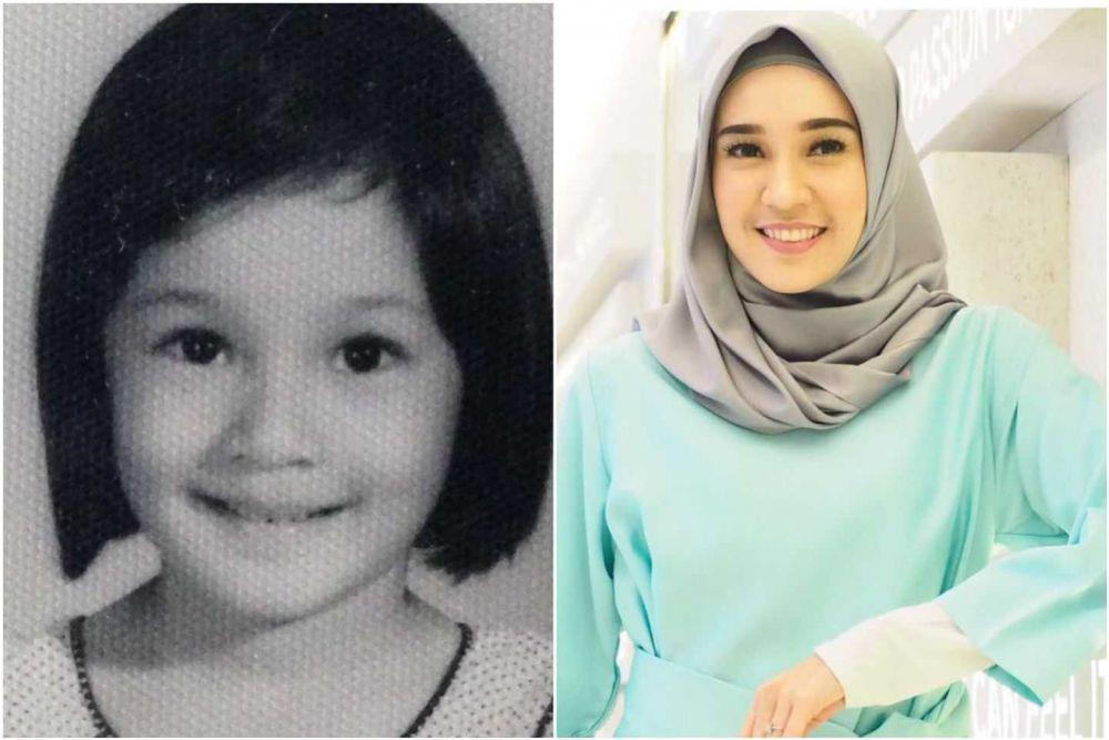 Intip 10 Potret Transformasi Dhini Aminarti yang Cantik Sejak Belia