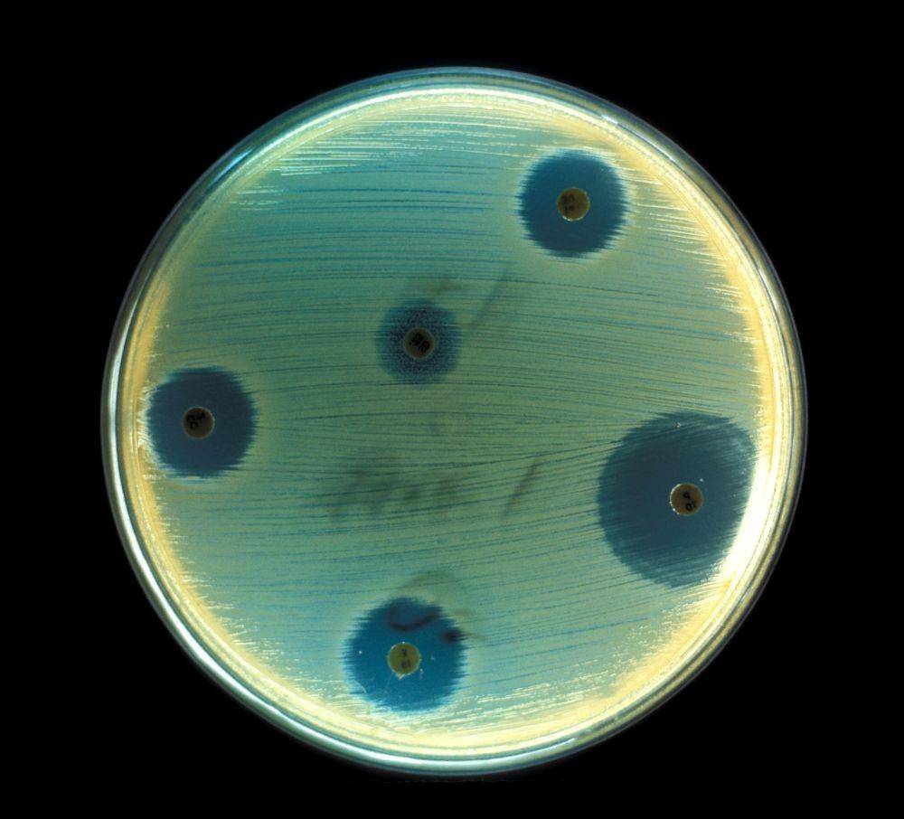Bakteri Staphylococcus aureus. pixnio.com/Don Stalons, USCDCP