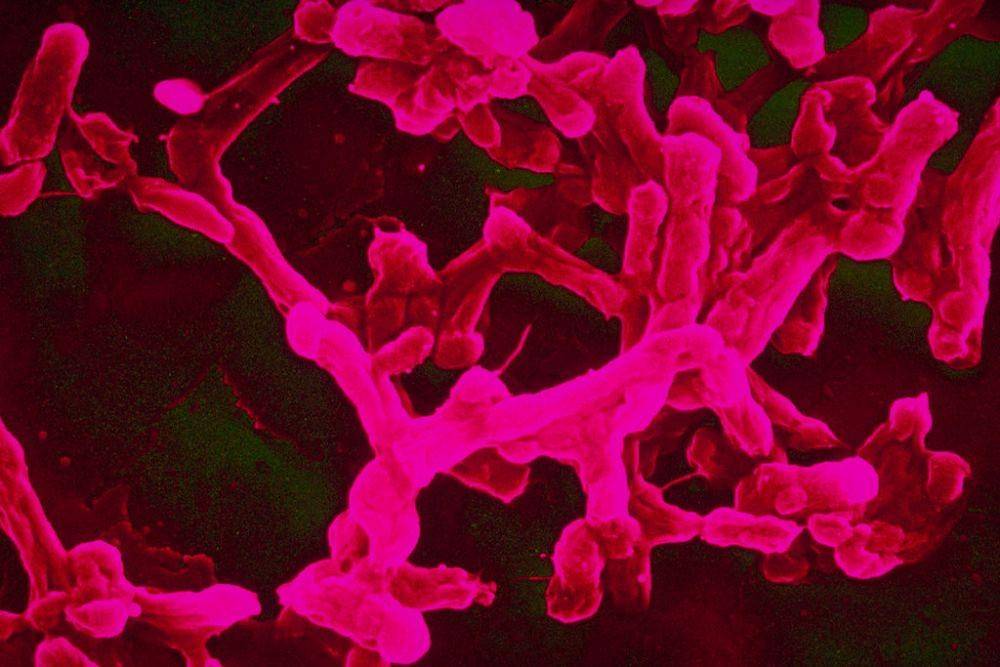 ilustrasi bakteri Salmonella typhi (flickr.com/Sanofi Pasteur)