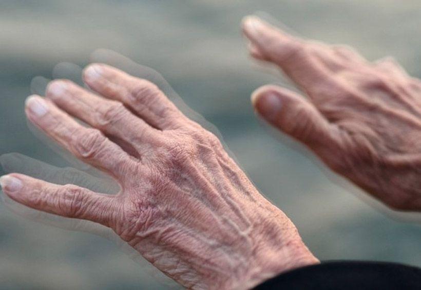 Bukan Sekadar Tremor, Ini 8 Fakta tentang Penyakit Parkinson