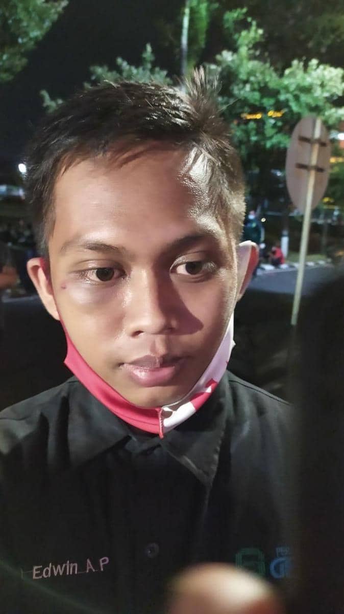 Kondisi Edwin Alfiansyah saat keluar dari Mapolda Jatim, Jumat (9/10/2020). Ia masih mengenakan seragam Persmanya namun dengan wajah lebam bekas tendangan. Dokumentasi Istimewa
