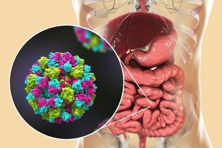 5 Cara Mencegah Penularan Norovirus, Jangan Sampai Tertular