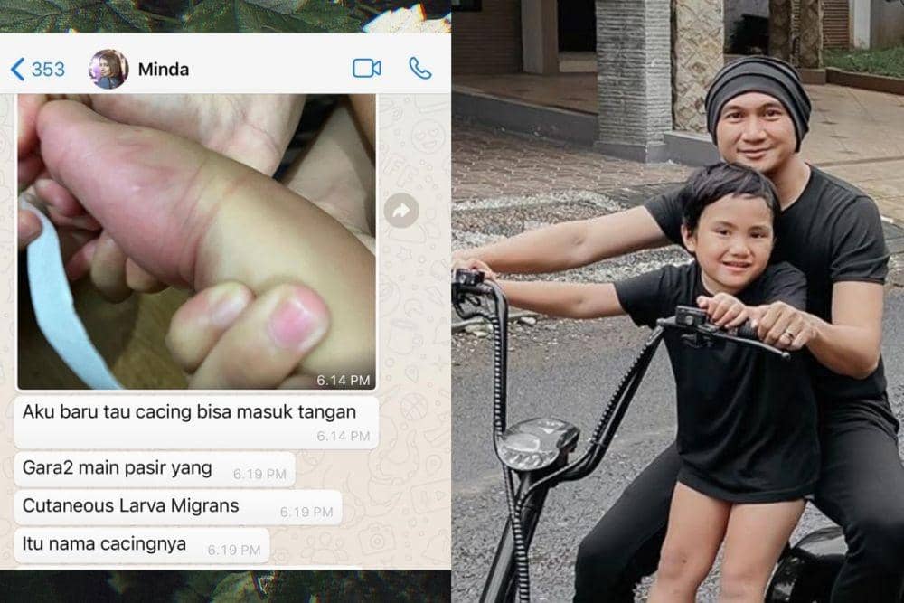 Anak Bungsu Kemasukan Cacing, 10 Potret Anji Momong Sigra