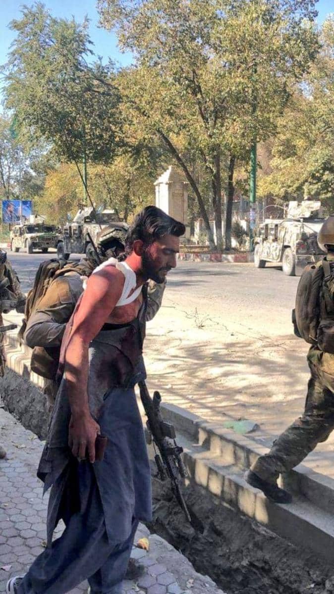 Salah satu korban penyerangan bersenjata di Universitas Kabul, Afghansitan, pada 2 November 2020. twitter.com/iihtishamm