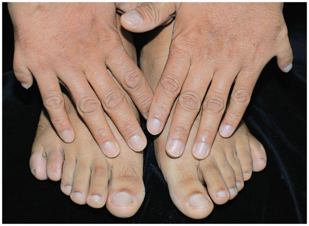 nejm.org