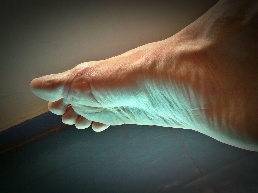 5 Tips Merawat Kulit Telapak Kaki agar Tidak Kering dan Mengelupas