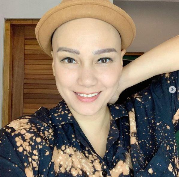 Dinyatakan Sembuh dari Kanker, 10 Potret Bugar Feby Febiola