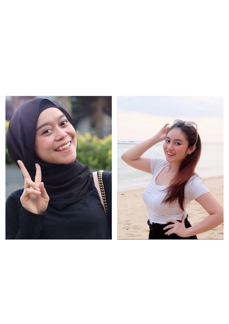 10 Potret Manis Artis dengan Gigi Gingsul, Irish Bella Pilih Dicabut