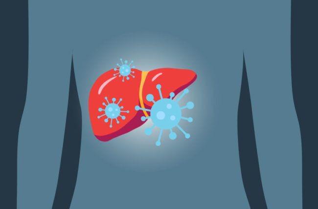 Dinkes Makassar Belum Siapkan Antisipasi Khusus Hepatitis Misterius
