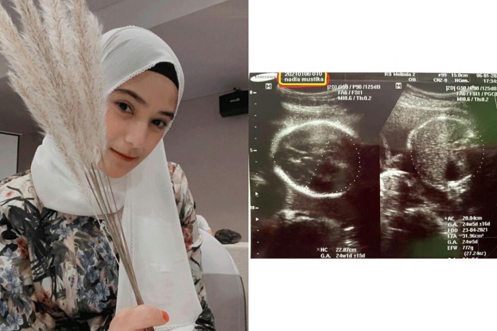 instagram.com/nadyamustikarahayu