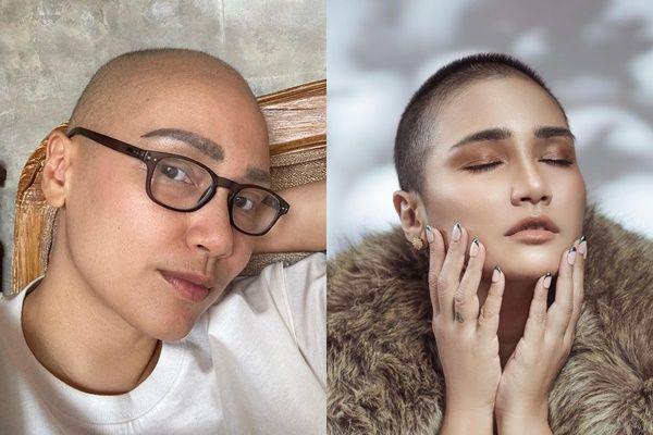 Survivor Kanker, 10 Potret Terbaru Feby Febiola Gunduli Rambut