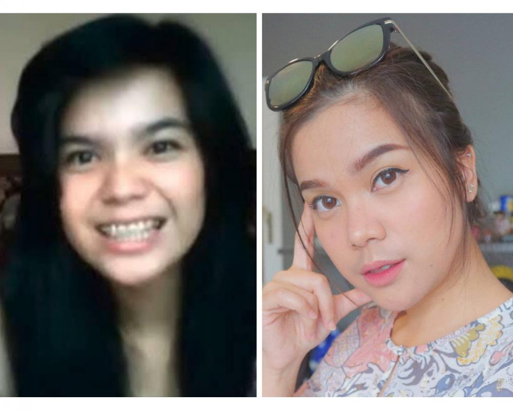 Ingat Sinta Keong Racun? Ini 10 Potretnya yang Tinggal di Luar Negeri