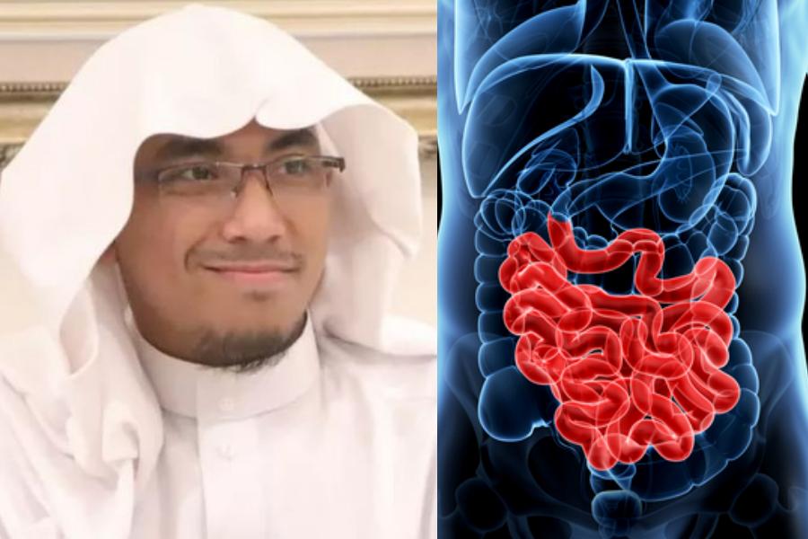Diidap Ustaz Maaher sebelum Meninggal, Ini 7 Fakta Infeksi TB Usus