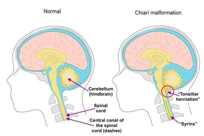 cnsneurosurgery.com.au