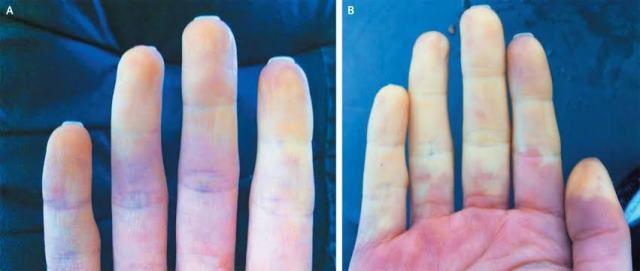 nejm.org