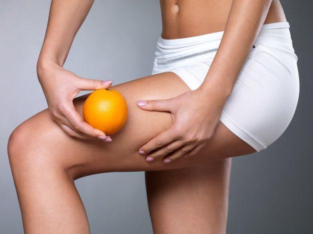 10 Mitos dan Fakta mengenai Selulit, Benarkah Cuma Dialami Perempuan?