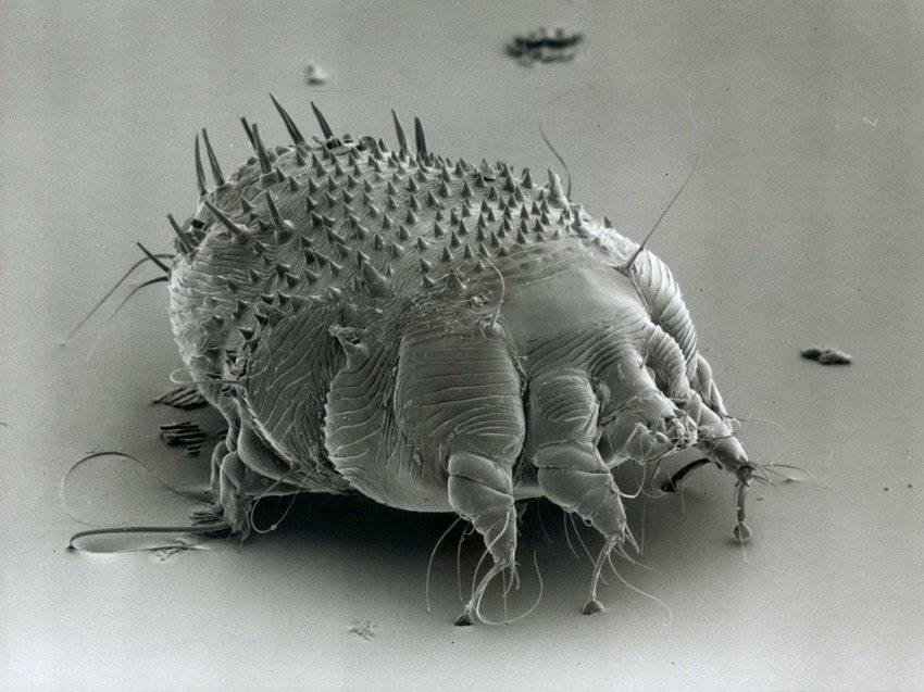 S. scabiei di bawah mikroskop. researchgate.net