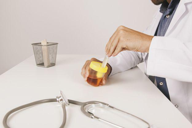 Kenali Penyakit Urine Sirup Maple, Mengubah Kencing Jadi Berbau Manis!