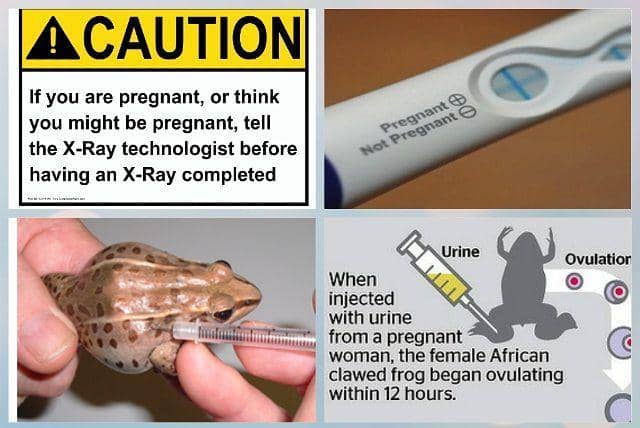 instagram.com/radiographybh