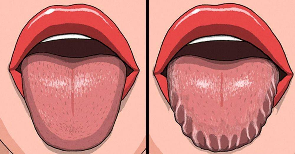 ilustrasi scalloped tongue (brightside.me)