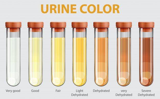 tanda dehidrasi yang bisa terlihat dari warna urine (freepik.com/brgfx)