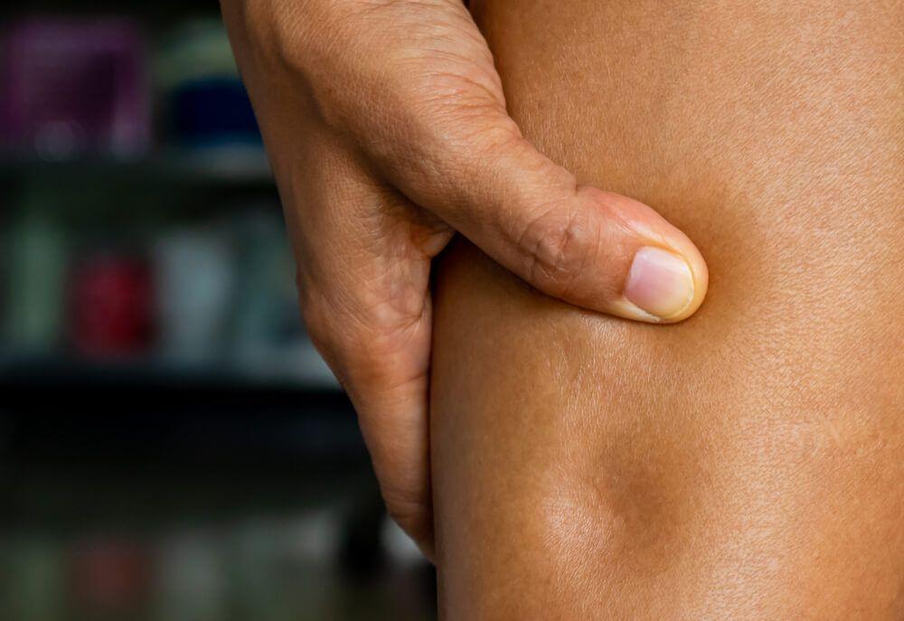 Bekas Kulit Gak Balik setelah Ditekan? Waspadai Pitting Edema