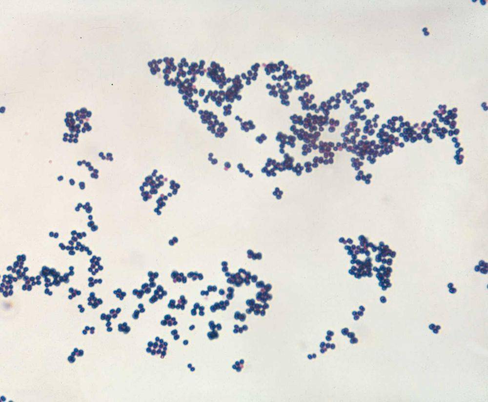 ilustrasi bakteri Staphylococcus aureus (britannica.com)