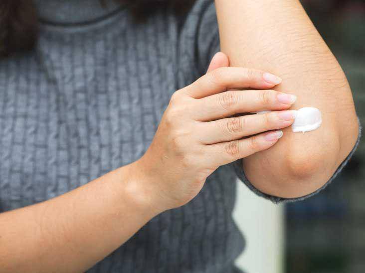 atasi siku menghitam(healthline.com)