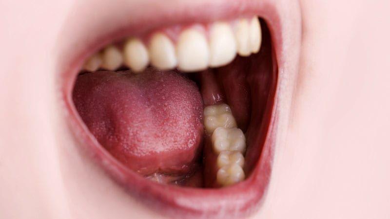 6 Fungsi Penting Saliva atau Air Liur dalam Rongga Mulut