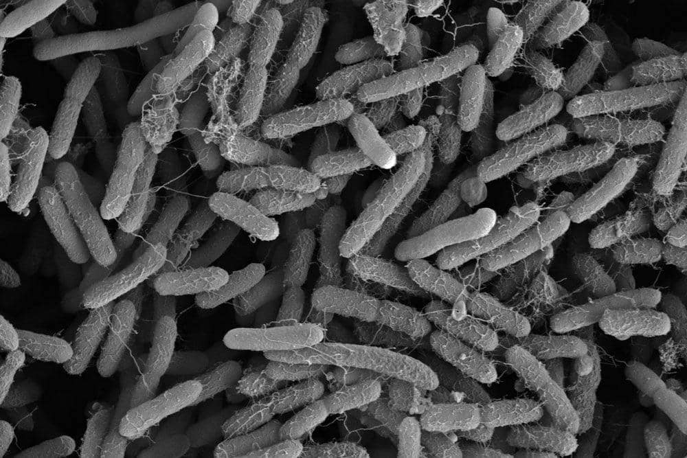 Potret bakteri dalam tangkapan mikroskop. (beesciencenews.com)